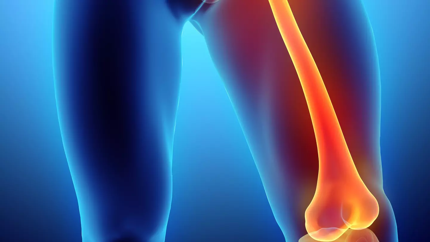 A photo of a woman's legs from the hips down she is wearing fishnet stockings and holding a cane